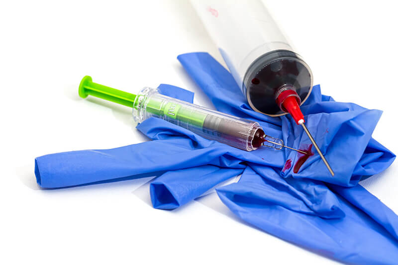 Déchets infectieux : les éliminer sur place à l’hôpital, c’est possible !
