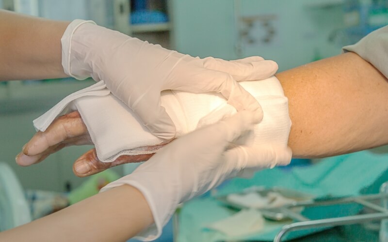 Les soins aux grands brûlés : une prise en charge multidisciplinaire en France
